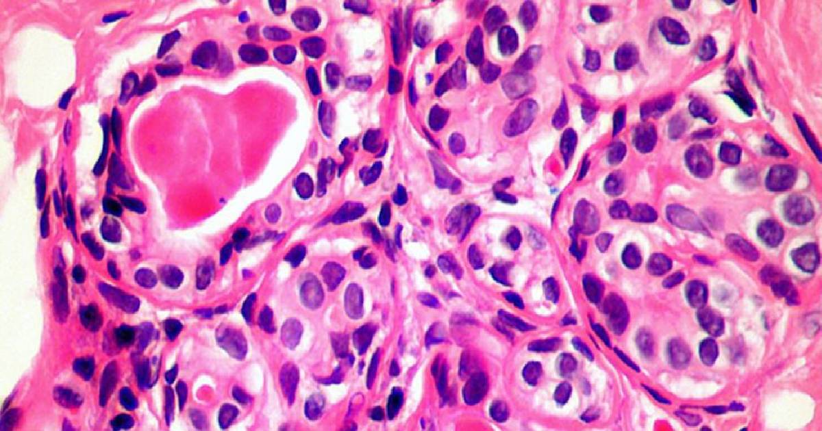 immune system , The Cardiff University team , Cancer