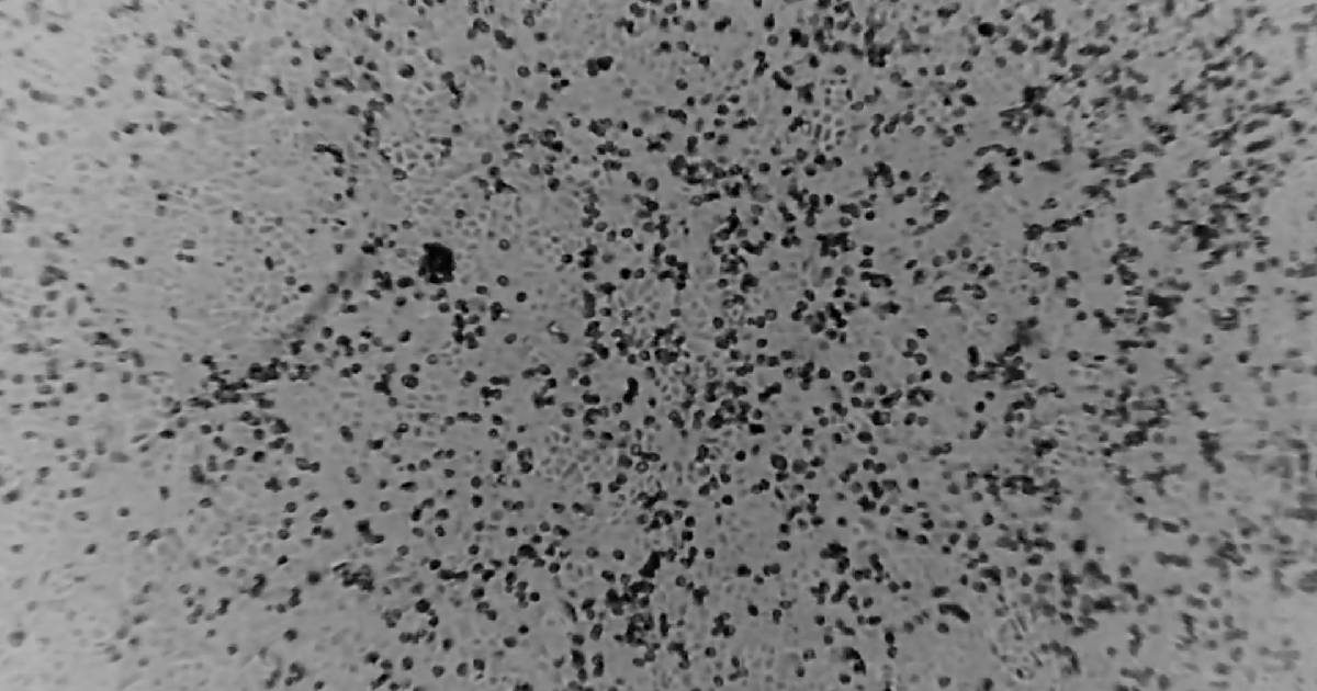 Hubei province , Peter Doherty Institute for Infection and Immunity. , virus outside China , World Health Organization (WHO) , coronavirus