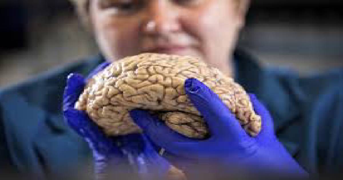 global clinical trial , Alzheimer , Alzheimer's drug , Chinese
