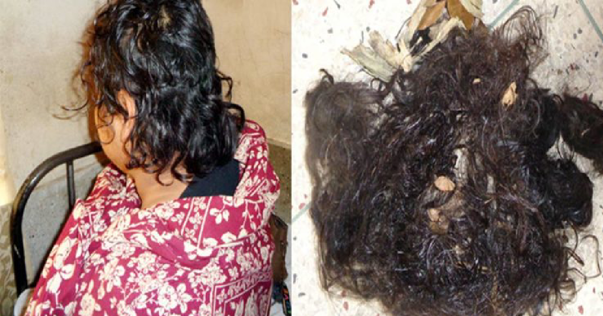 Jashore , woman tortured , Woman’s hair cut off , Chowgaccha , arrested